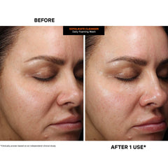 Nighttime cleanse with Exfolikate Cleanser for smoother texture.