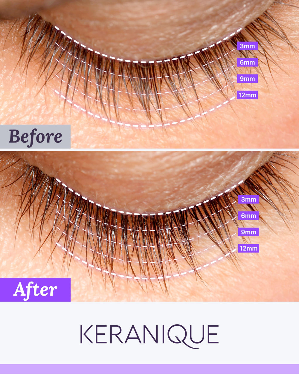 Keranique Lash Growth Serum packaging front highlighting premium lash enhancement
