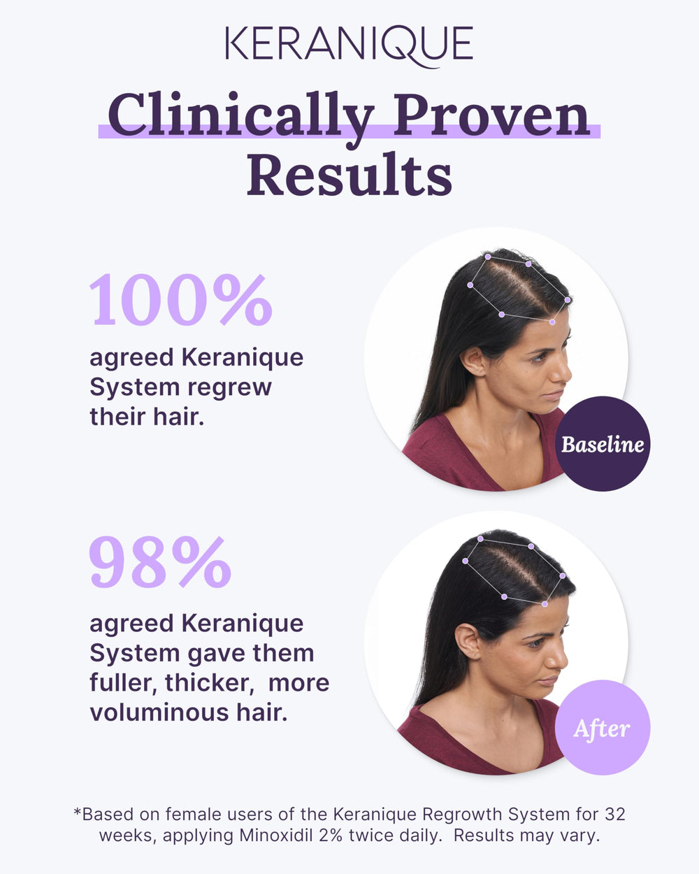 Keranique scalp close-up showing healthier texture after use