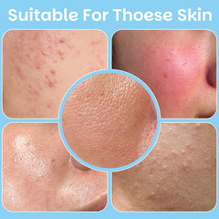 Kestper Oil-control closeup demonstrates matte finish for oil-prone skin.