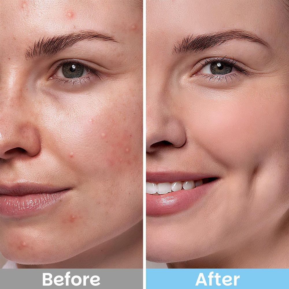 Kestper Dual-textured Pad closeup shows exfoliation plus soothing botanicals.