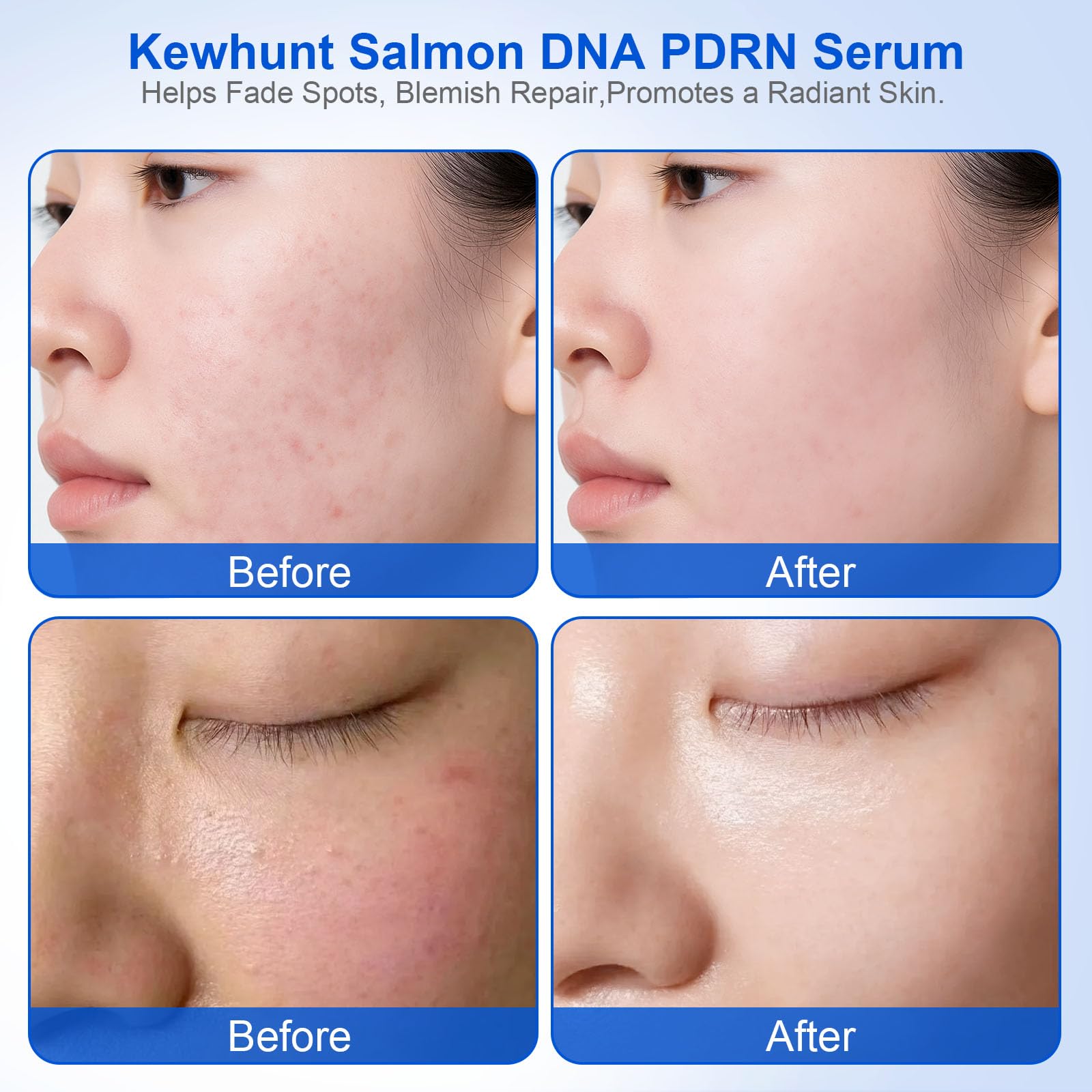 Kewhunt serum emphasizes collagen-boosting ingredients for firmer-looking skin.