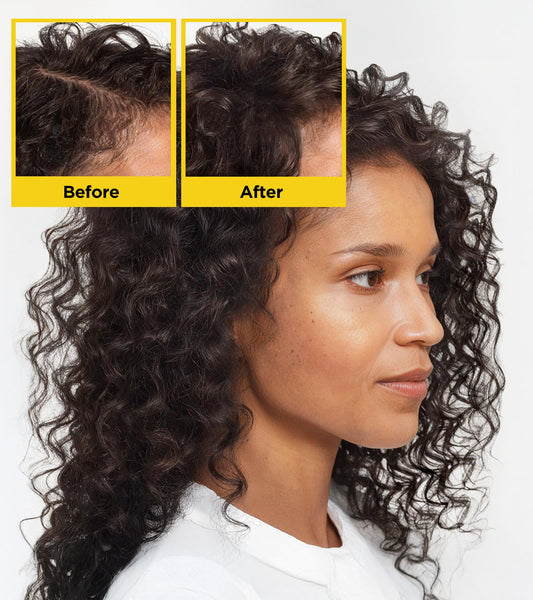 Close up of KGUSIS Root Activator ingredients with rosemary and Batana oil