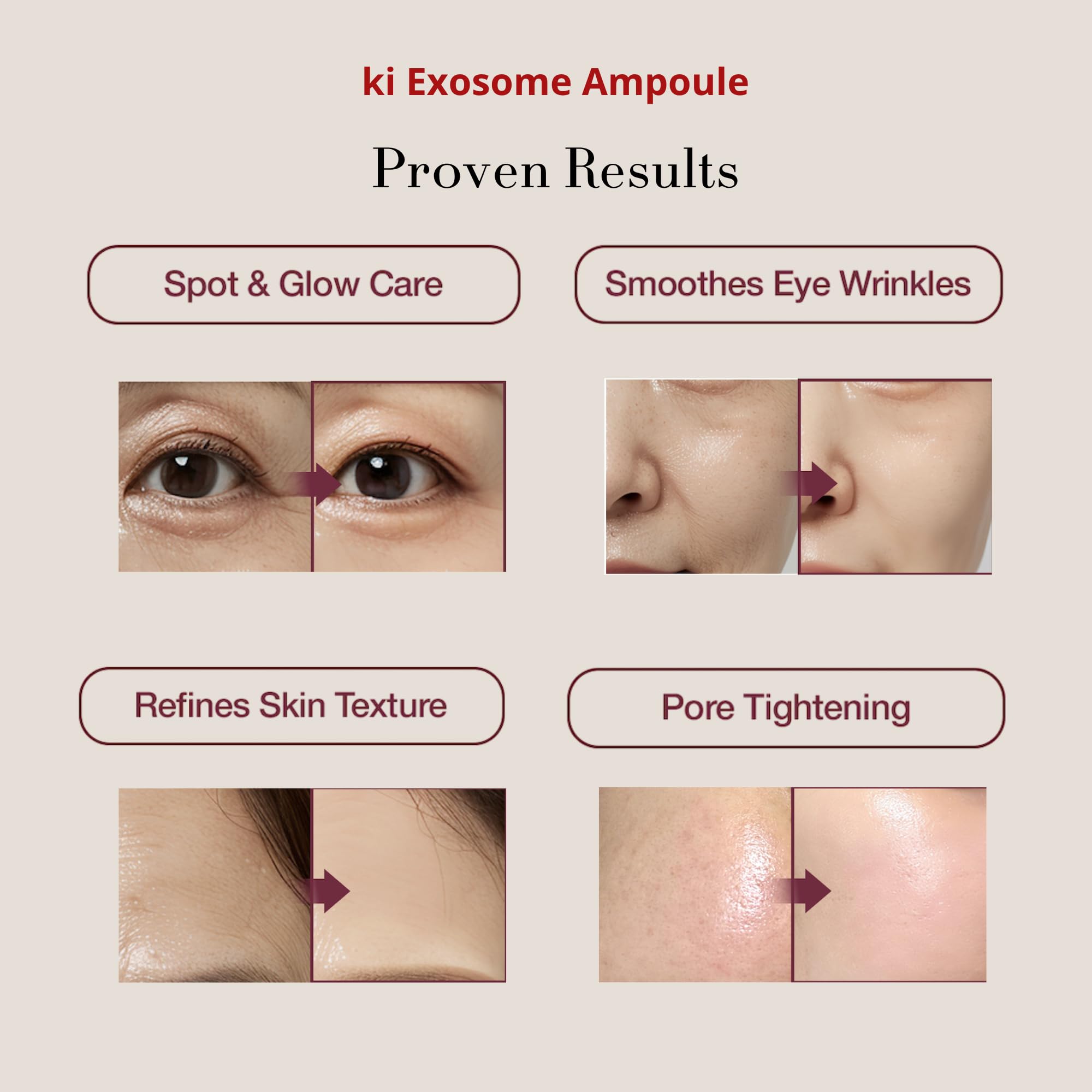 Ki Cosmetics exosome ampoules close-up bottle 2 supporting elasticity
