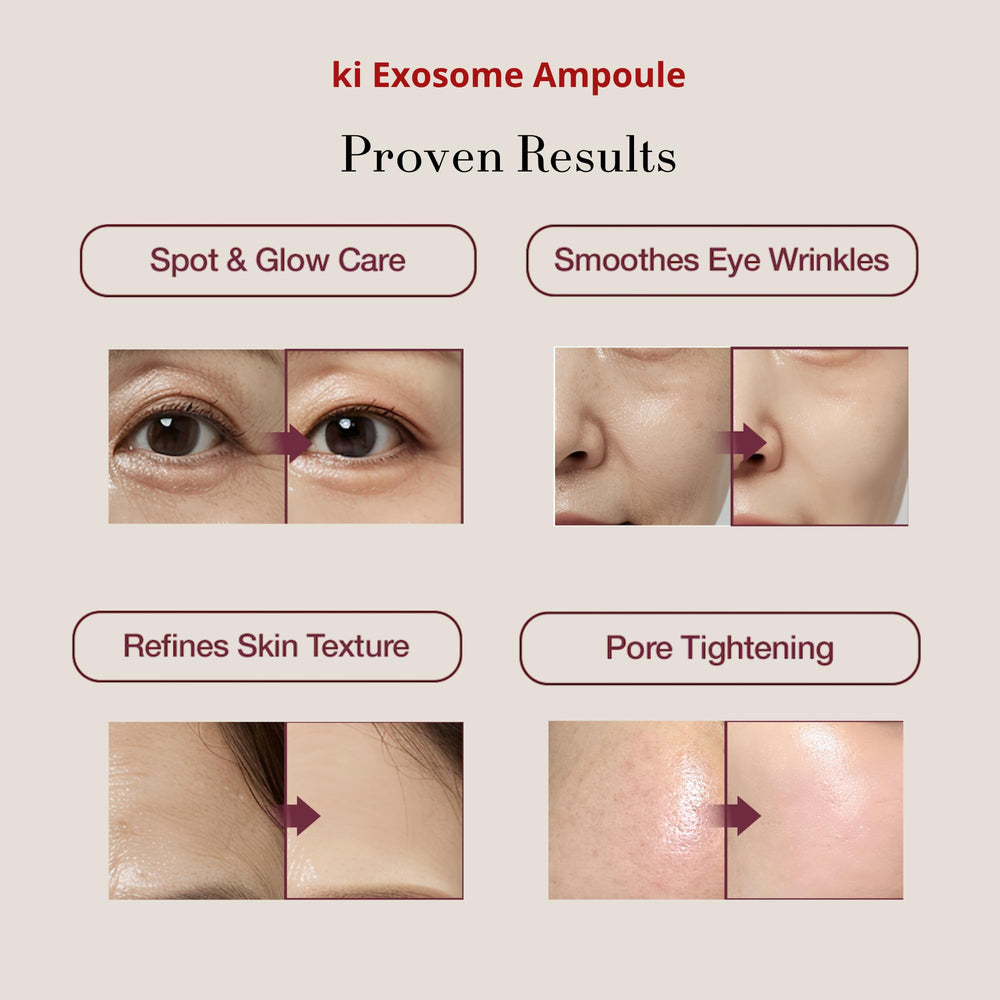 Ki Cosmetics exosome ampoules close-up bottle 2 supporting elasticity