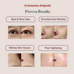 Ki Cosmetics exosome ampoules close-up bottle 2 supporting elasticity