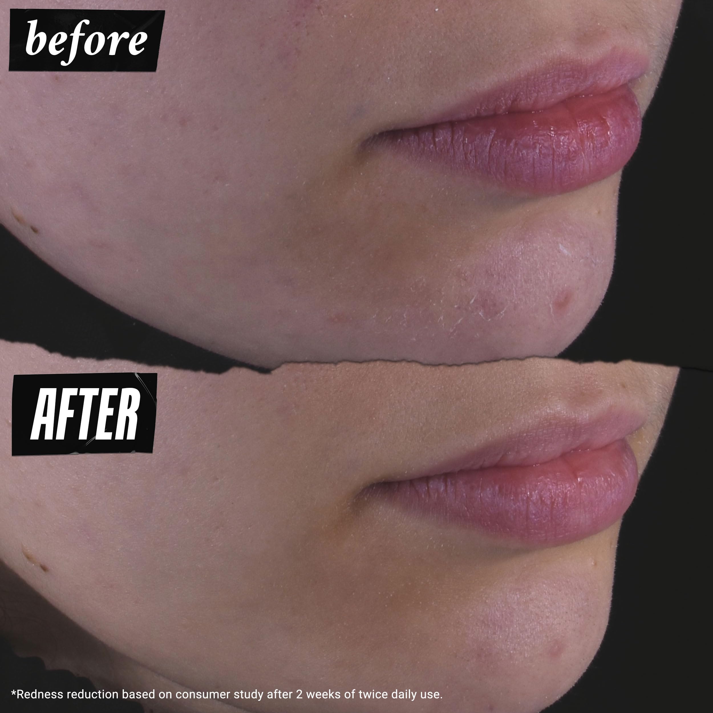 Kiehl's Calendula toner being swept across the face during routine.