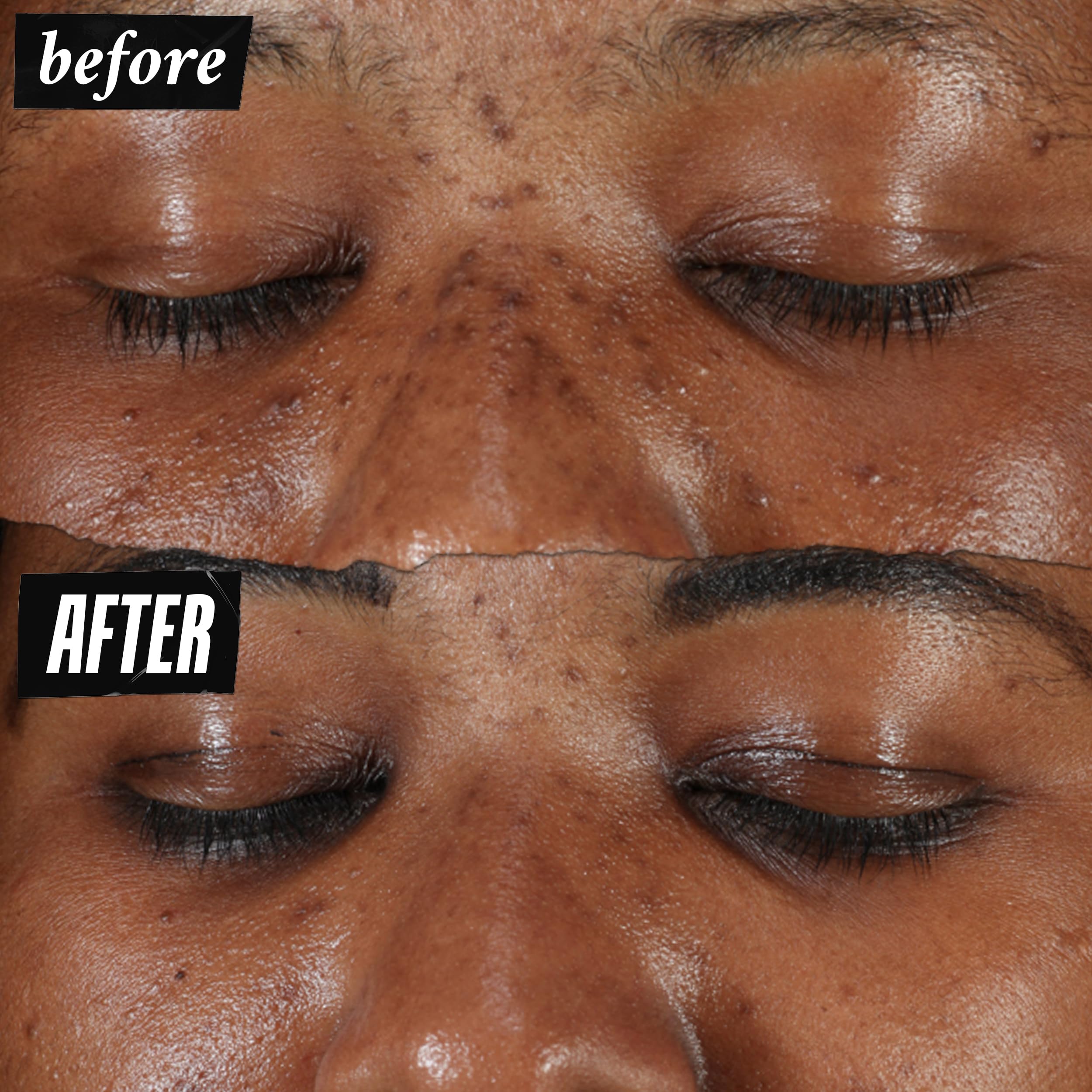 Kiehl's Clearly Corrective serum drop close-up indicating precise spot treatment.