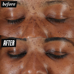 Kiehl's Clearly Corrective serum drop close-up indicating precise spot treatment.