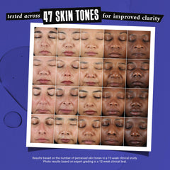 Kiehl's Clearly Corrective serum face close-up showcases radiant, clarified skin.