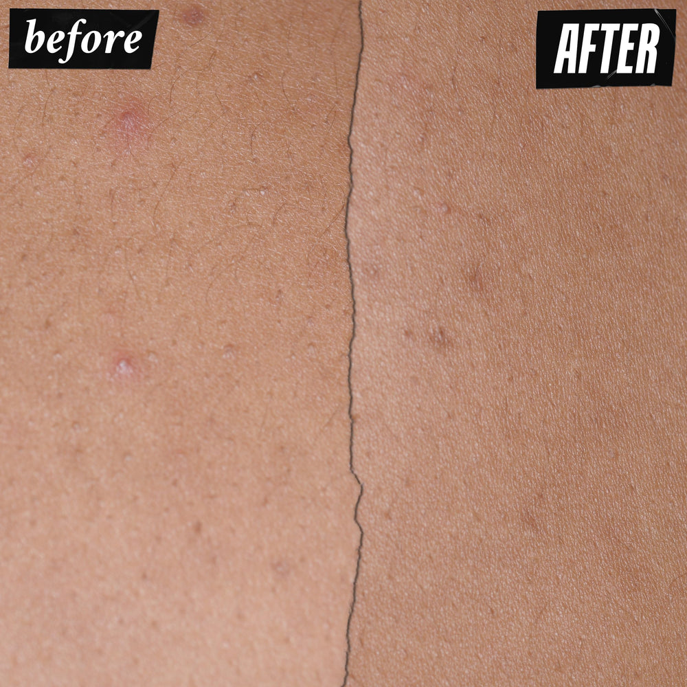 Kiehl's Expertly Clear postbiotic Lactobacillus Ferment ingredient close-up