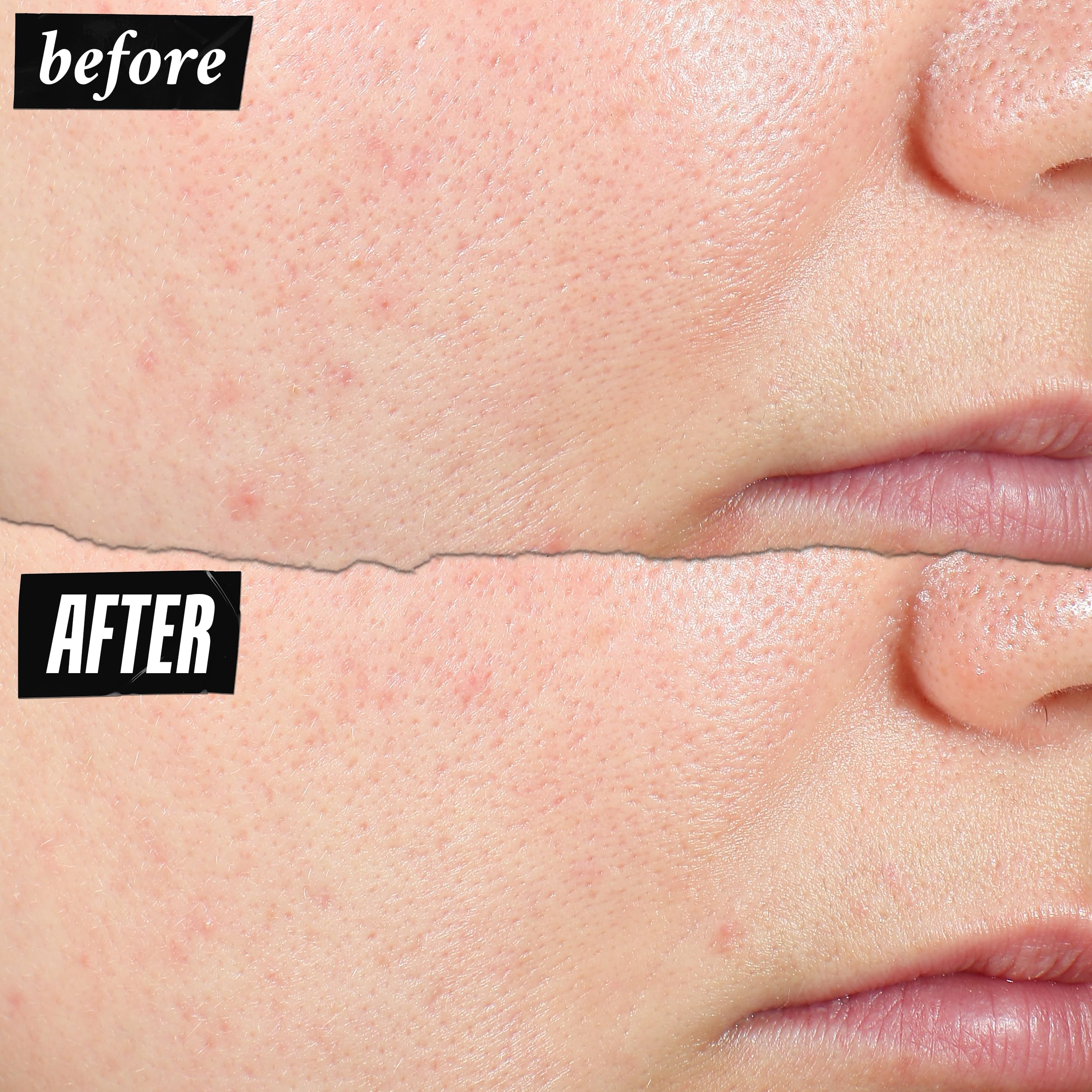 Kiehl's Expertly Clear pump-top for easy, even daily application