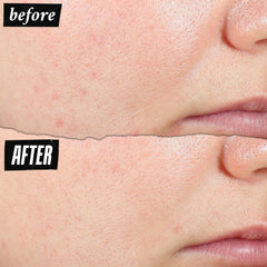 Kiehl's Expertly Clear pump-top for easy, even daily application
