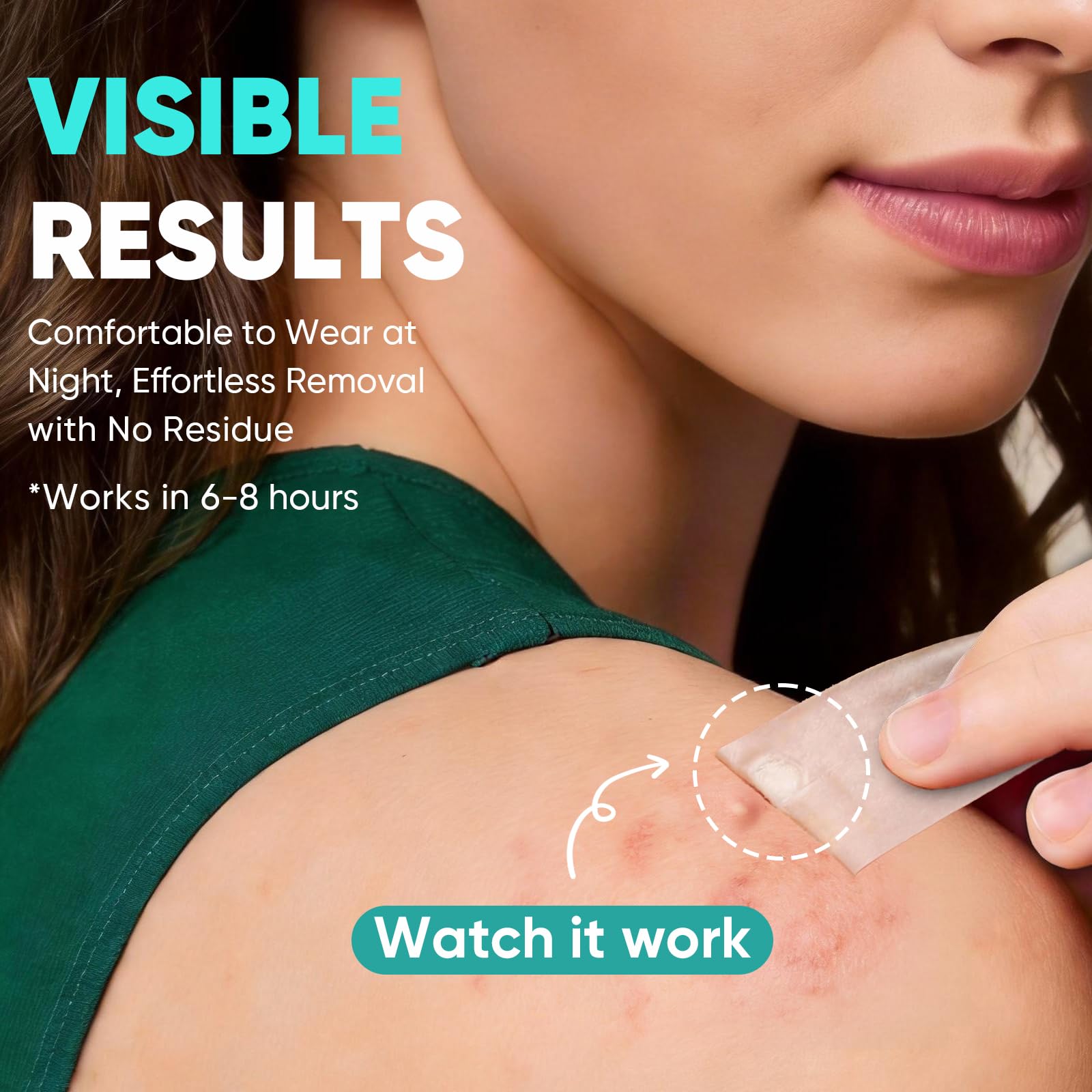 Kindshine hydrocolloid patches close-up illustrating fluid drawing action.