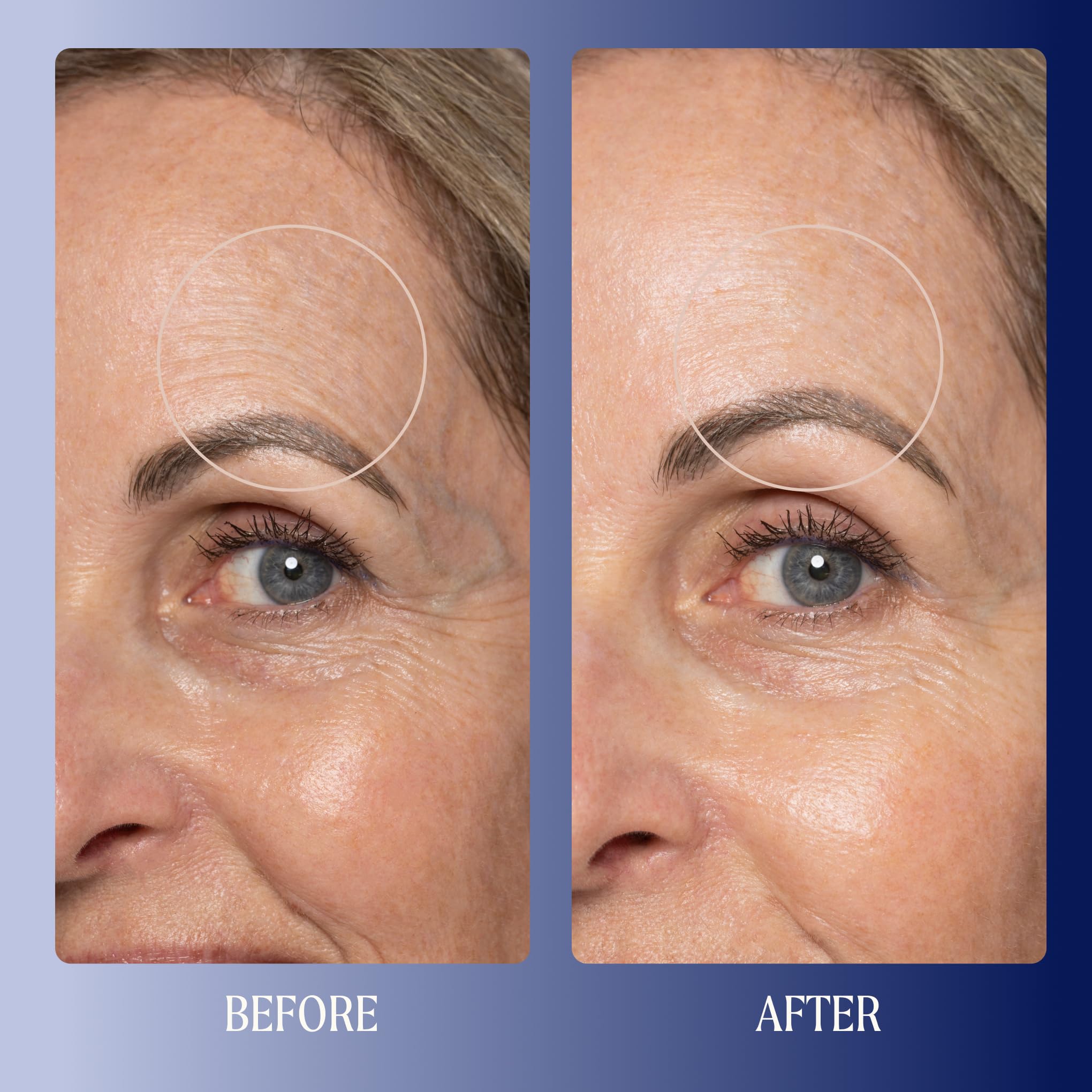 Kinship triple ceramide complex closeup points to barrier-repair benefits.