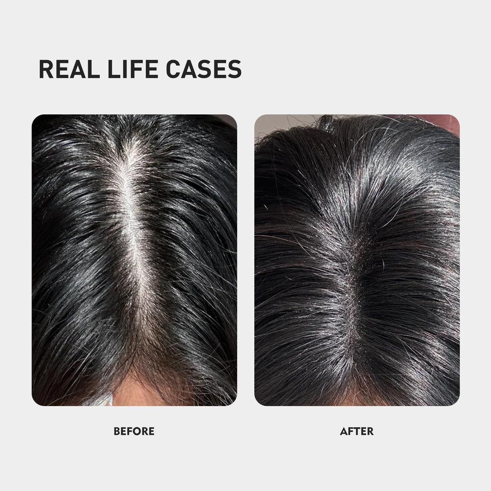 KINTOR KX-826 hair strands showing fuller appearance