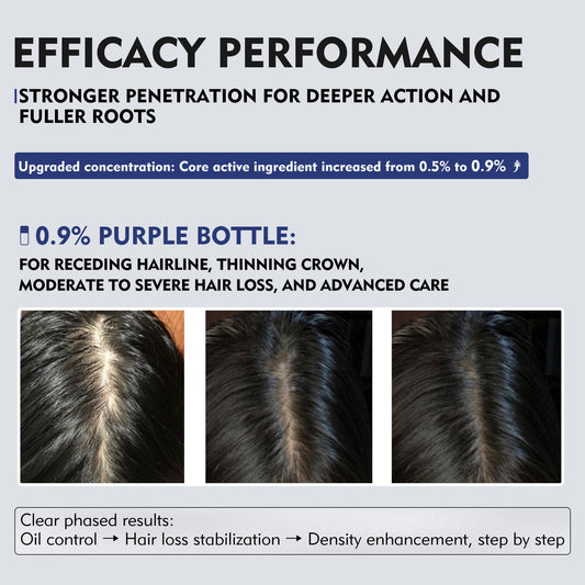KINTOR KX-826 applying spray to the scalp for focused hair care.