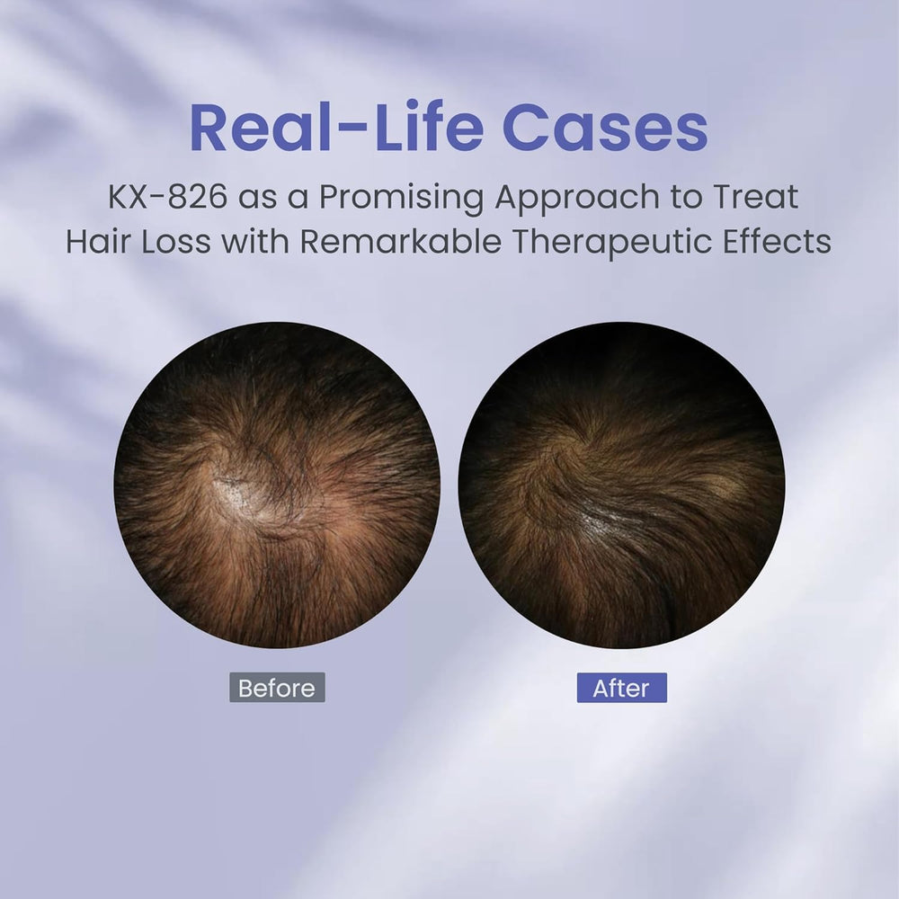 KINTOR KX-826 uses mild ingredients to reduce irritation