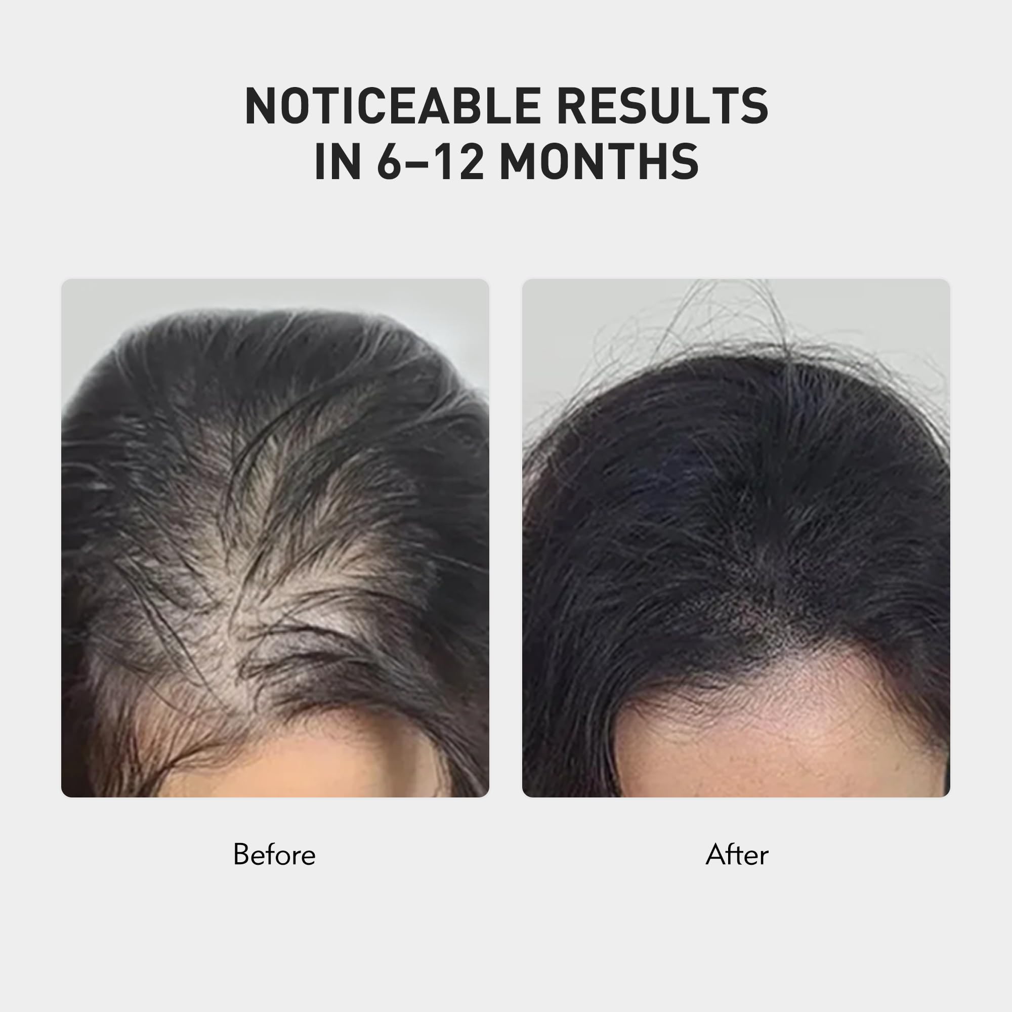 KINTOR KX-826 spray mist during application for strong, nourished follicles