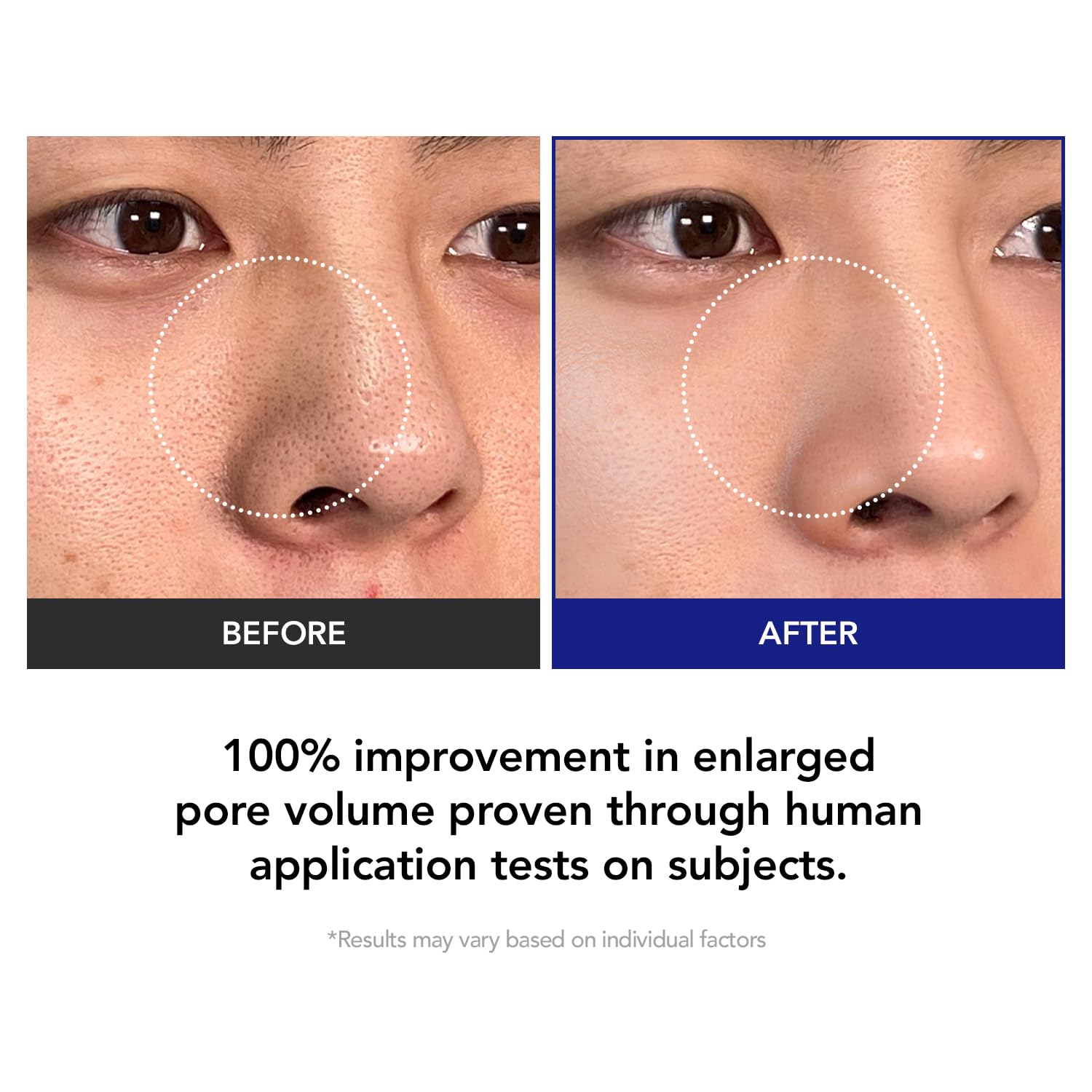Kioskkin Triple-Acid Exfoliation blends AHA, BHA, and PHA for refined texture.
