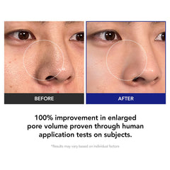 Kioskkin Triple-Acid Exfoliation blends AHA, BHA, and PHA for refined texture.