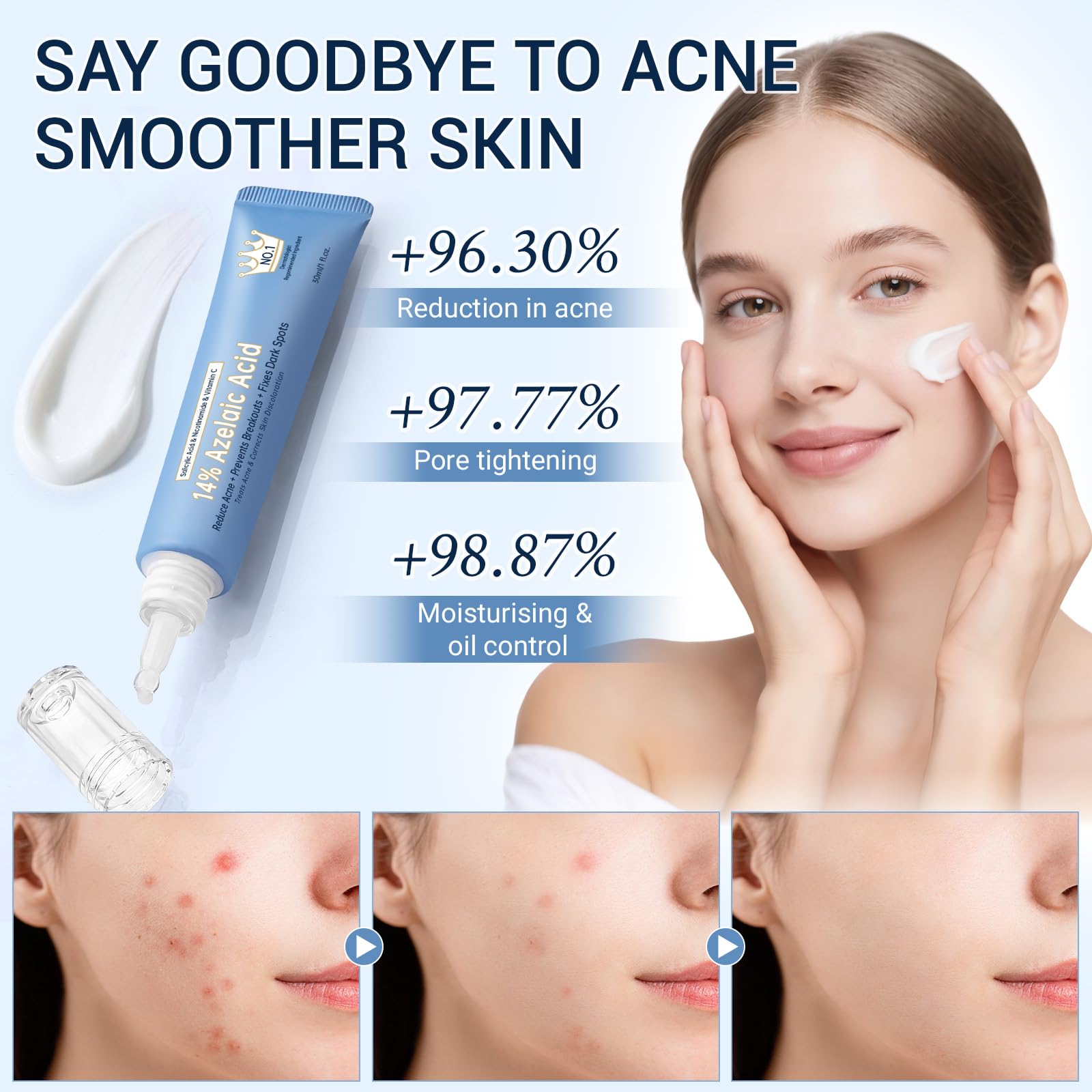 KIUORET cream offers oil control while keeping skin balanced.