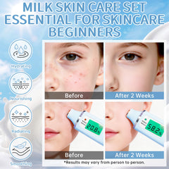 KIUORET Milk Skincare Set serum, boost moisture with hyaluronic acid for dry skin.
