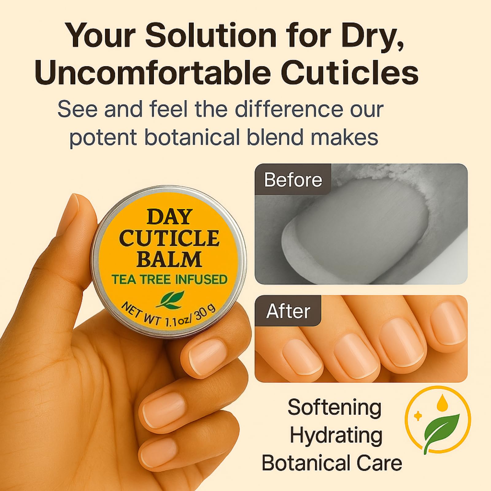 Cuticle-softener action on rough skin around the nail by KmaxShip.