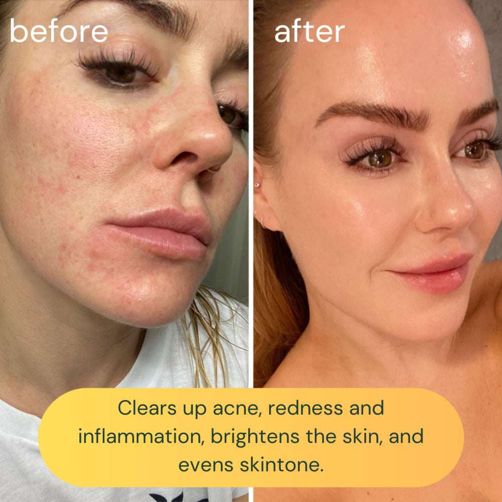 Lavender oil in KOA LIFE cleanser supports soothing, clear skin
