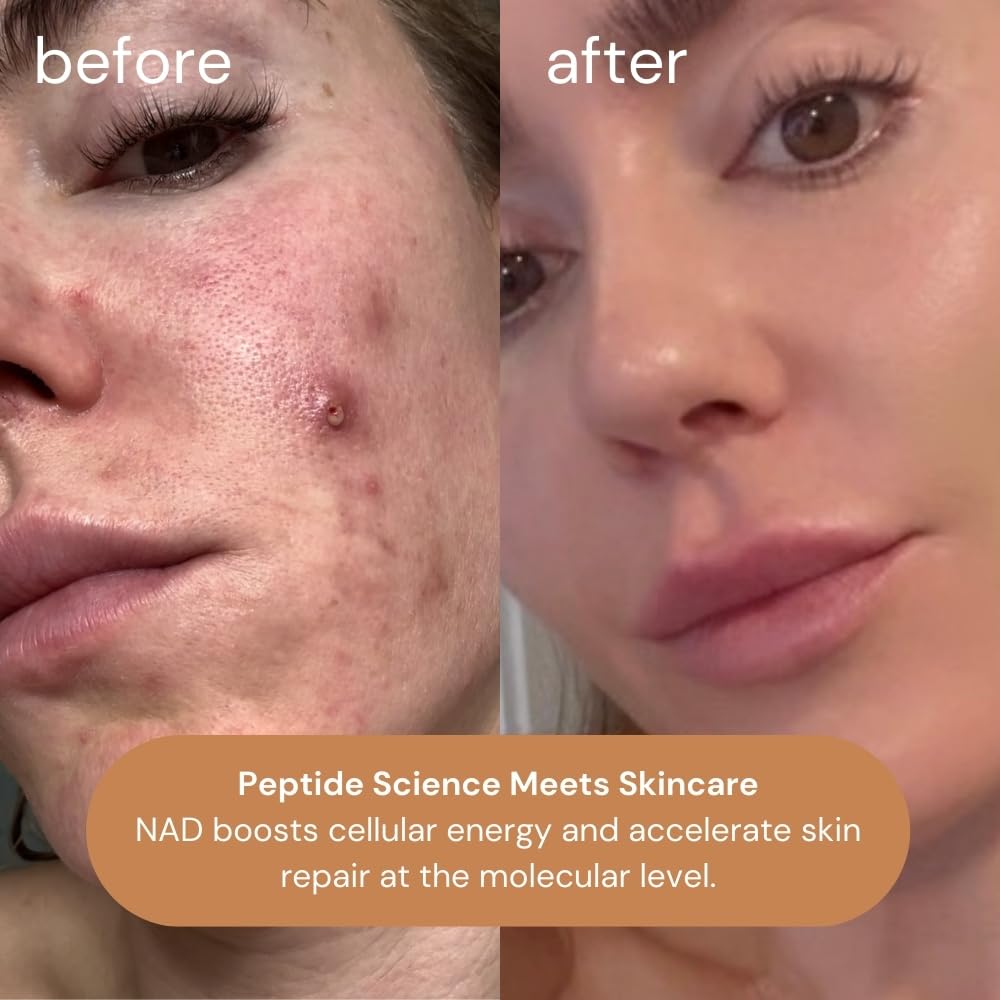 KOA LIFE NAD Peptide Serum outer carton in copper finish