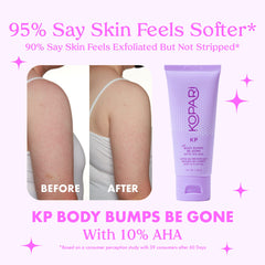 Kopari KP Body Bumps Exfoliator texture closeup highlights gentle exfoliation.