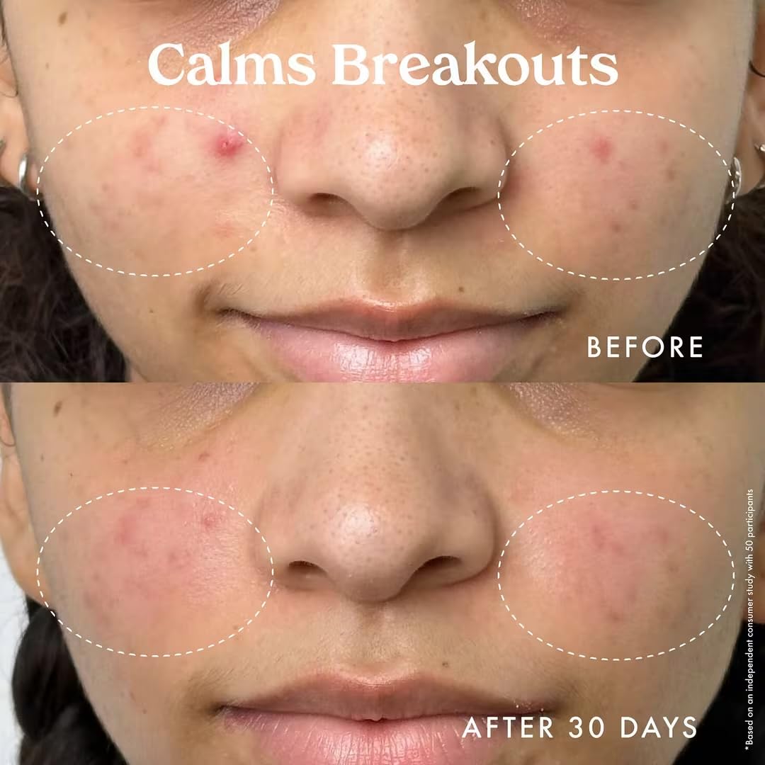 Kopari Niacinamide ingredient panel emphasizes soothing barrier-supporting benefits.