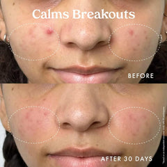 Kopari Niacinamide ingredient panel emphasizes soothing barrier-supporting benefits.
