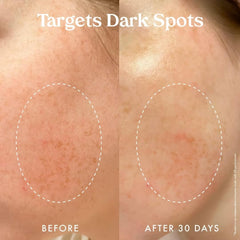 Kopari Skin hydration glow conveys even-toned, refreshed skin appearance.