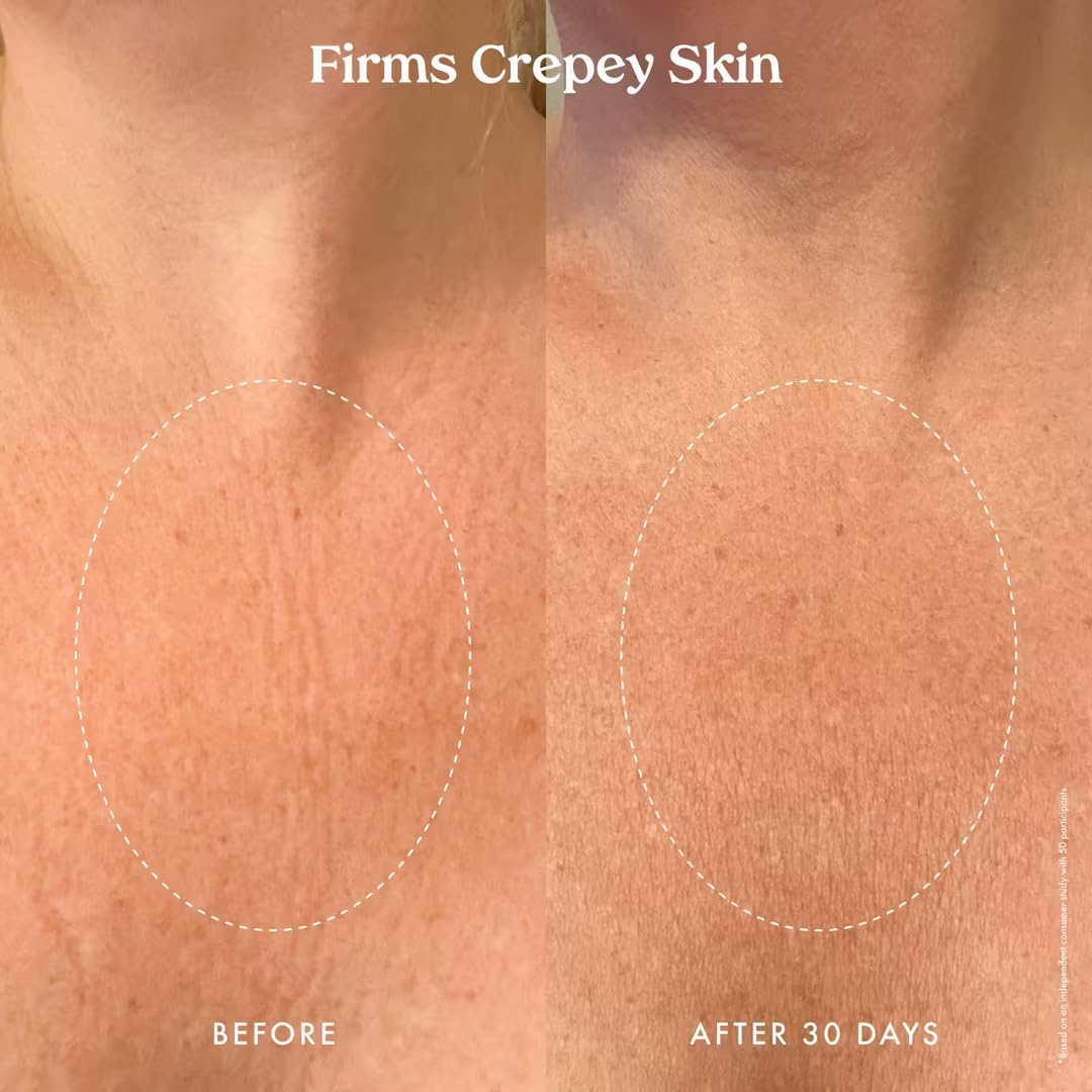 Kopari Ultra Renewal Retinol Body Cream applied in daily routine for skin softness