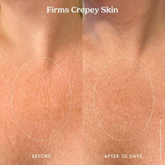 Kopari Ultra Renewal Retinol Body Cream applied in daily routine for skin softness