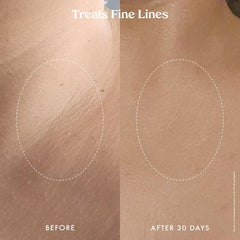 Kopari Ultra Renewal Retinol Body Cream addressing crepey skin on limbs