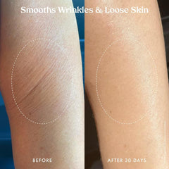 Kopari Ultra Renewal Retinol Body Cream demonstrating firmer feel and elasticity