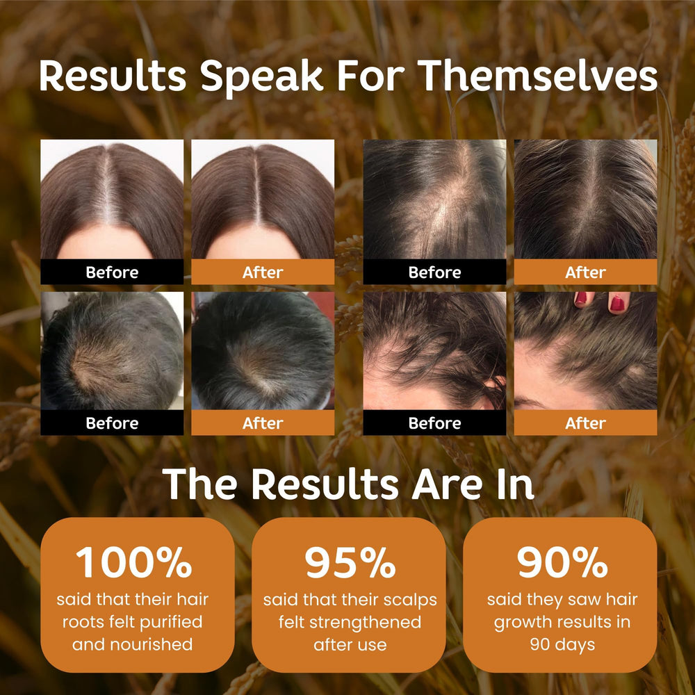 Kovilea Rice Water Shampoo pour shows easy distribution for cleansing.