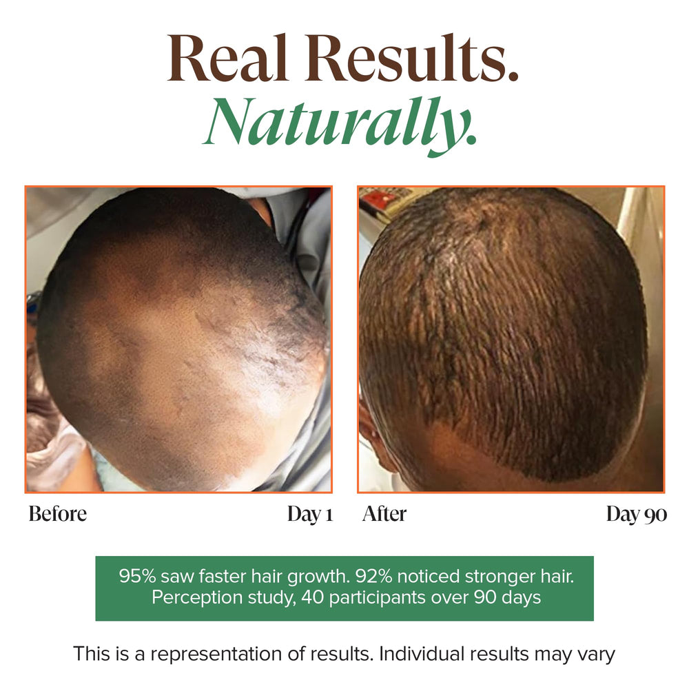 Scalp massage application demonstrating how to apply to roots.