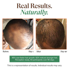 Scalp massage application demonstrating how to apply to roots.