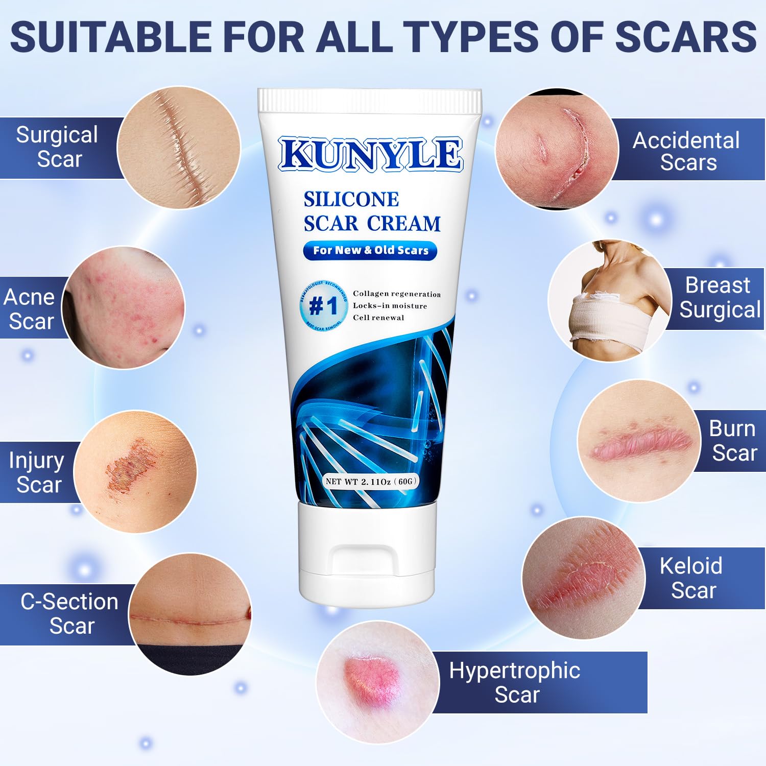 Kunyle Scar Cream gel texture closeup showing quick absorption