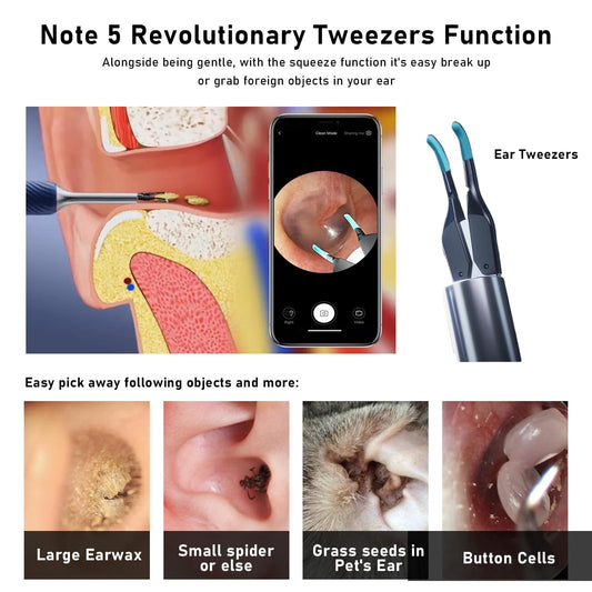 KWYBOW Note5 10MP otoscope view reveals detailed ear canal.