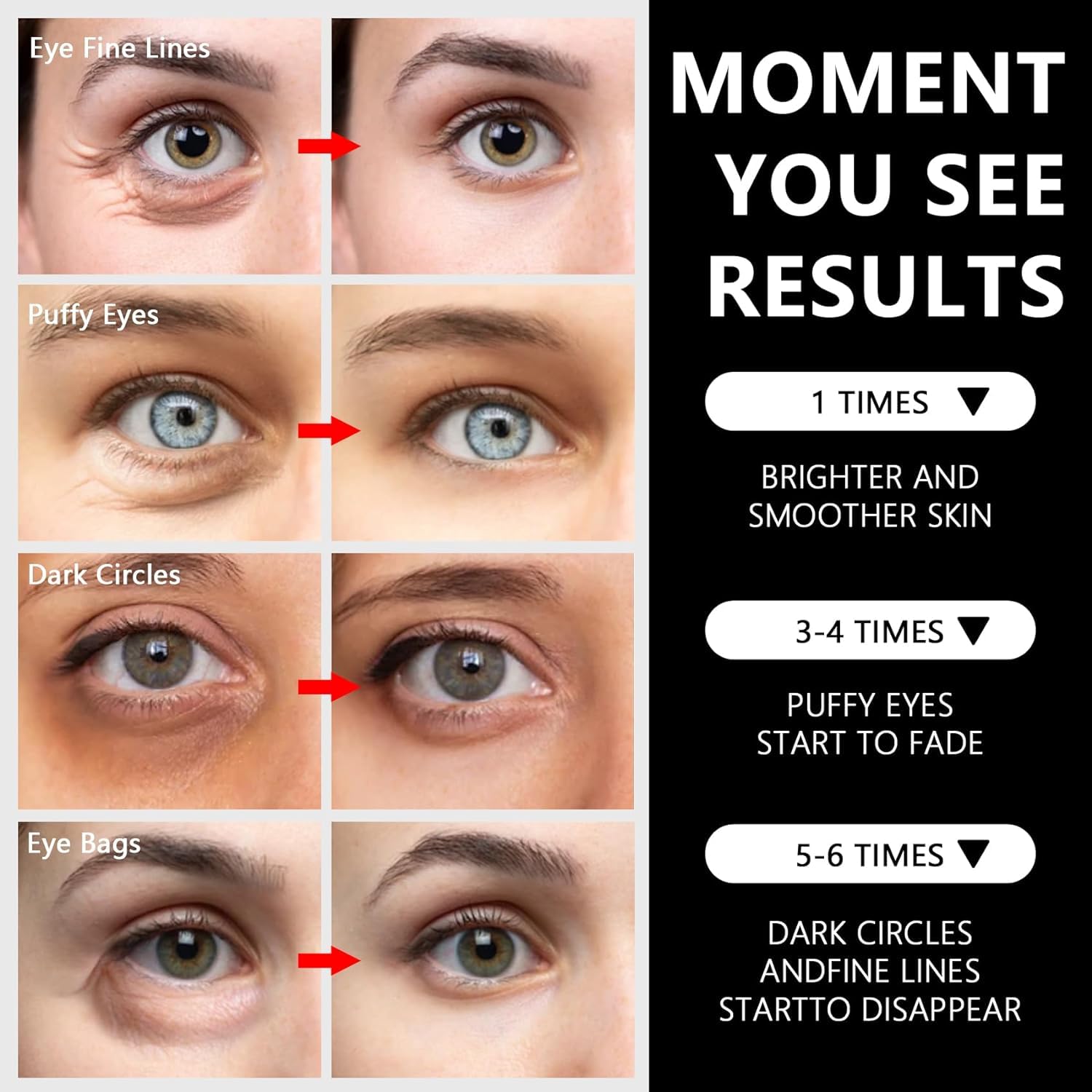 LA MIURA under-eye patches applied to eye area for potential puffiness relief.