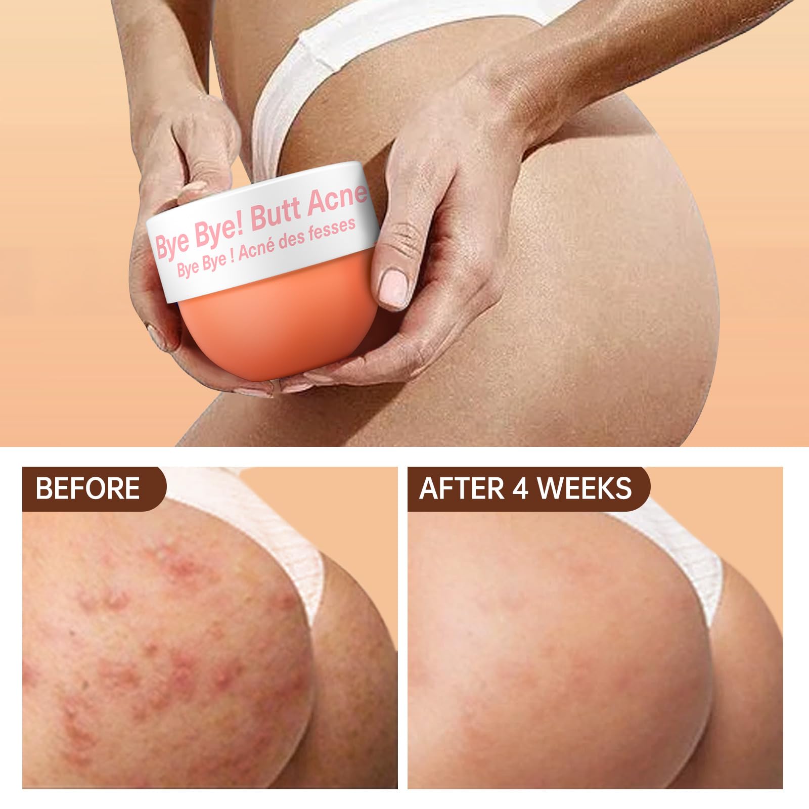 LA.PERSONAL butt acne cream texture closeup shows non-greasy finish