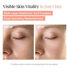 Laboreve PeachMicrobiome 84 EGF Serum hyaluronic acids layer for deep moisturization.
