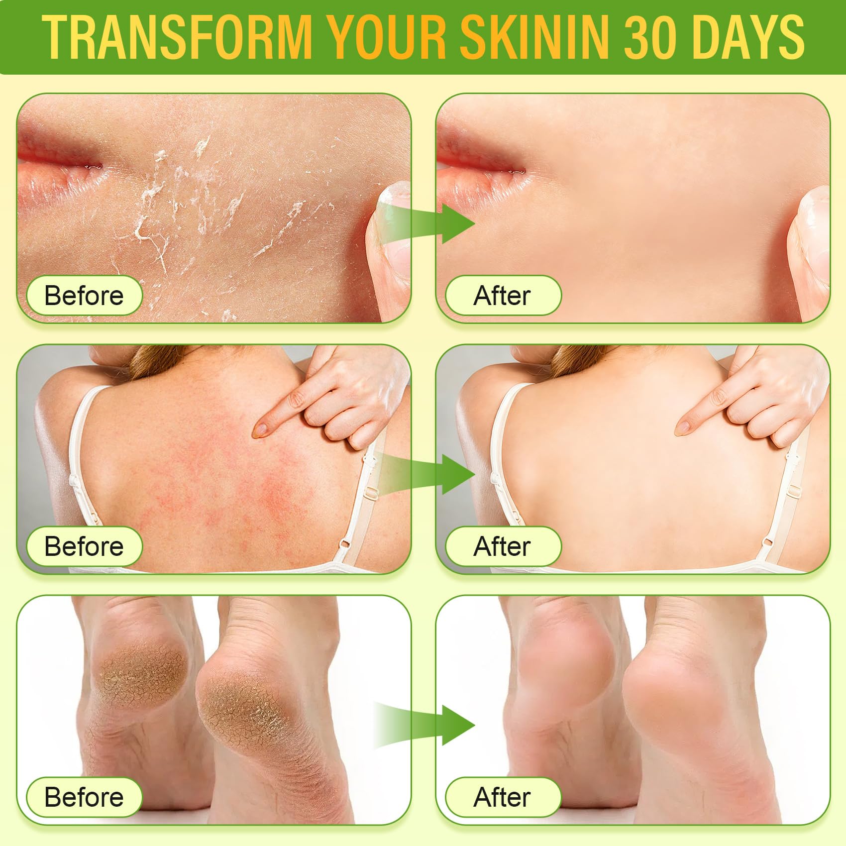 LAITYUM skin nourishment with calendula and honey for sensitive skin