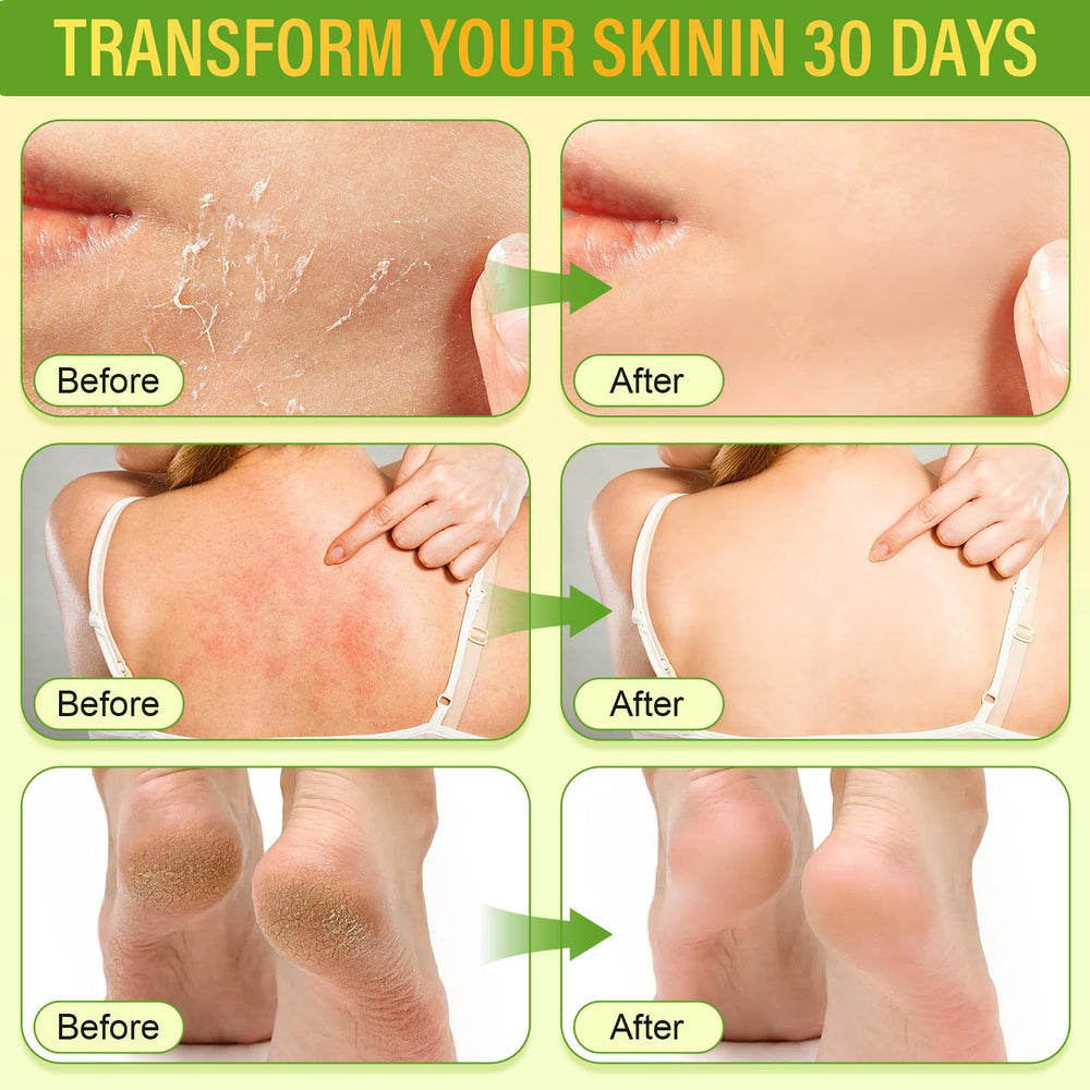 LAITYUM skin nourishment with calendula and honey for sensitive skin