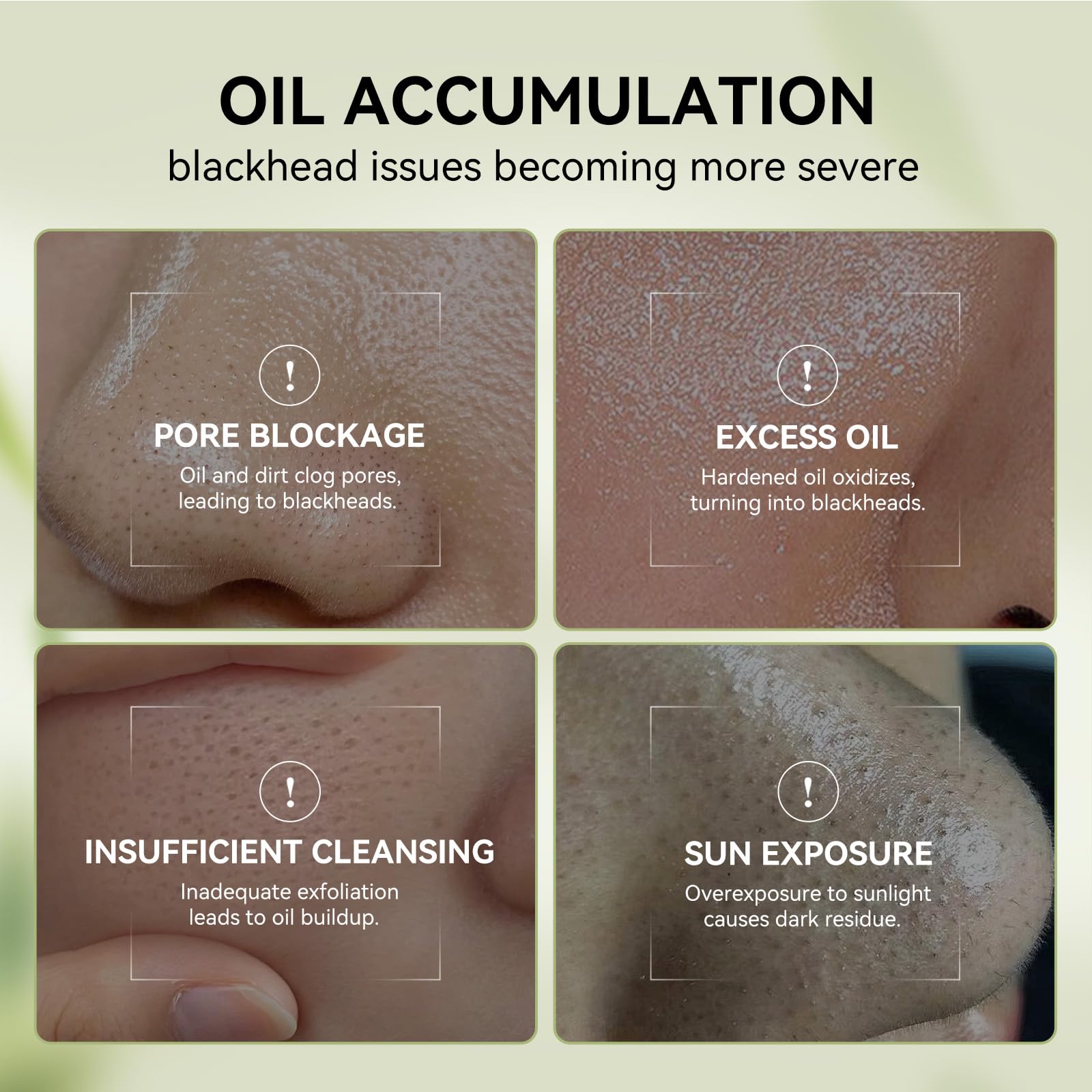 LANBENA removal paper stack for efficient, mess-free blackhead removal.