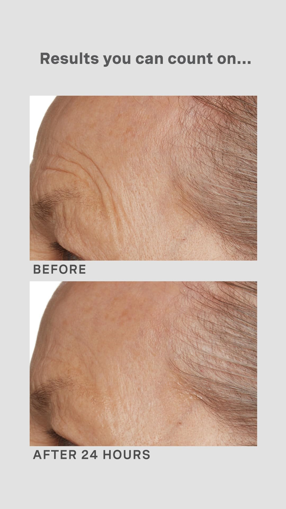 Lancer Gravity Defying Moisturizer packaging highlights professional-grade formulation